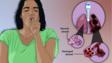 描绘一个女人患有肺气肿,慢性阻塞性肺疾病的一种