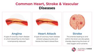 信息图表对心脏、中风和血管性疾病
