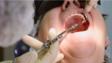 牙医做局部麻醉手术前拍摄的。高级的女人在牙科诊所。牙医助理植入病人的嘴安装在现代牙科办公室